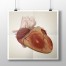 Medical Illustrations